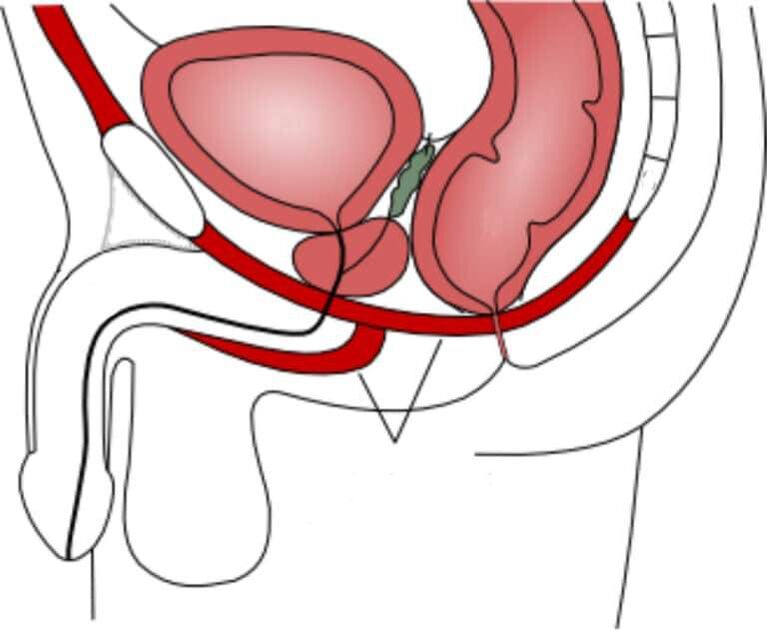 oiliúint na matáin pelvic urlár potency a fheabhsú